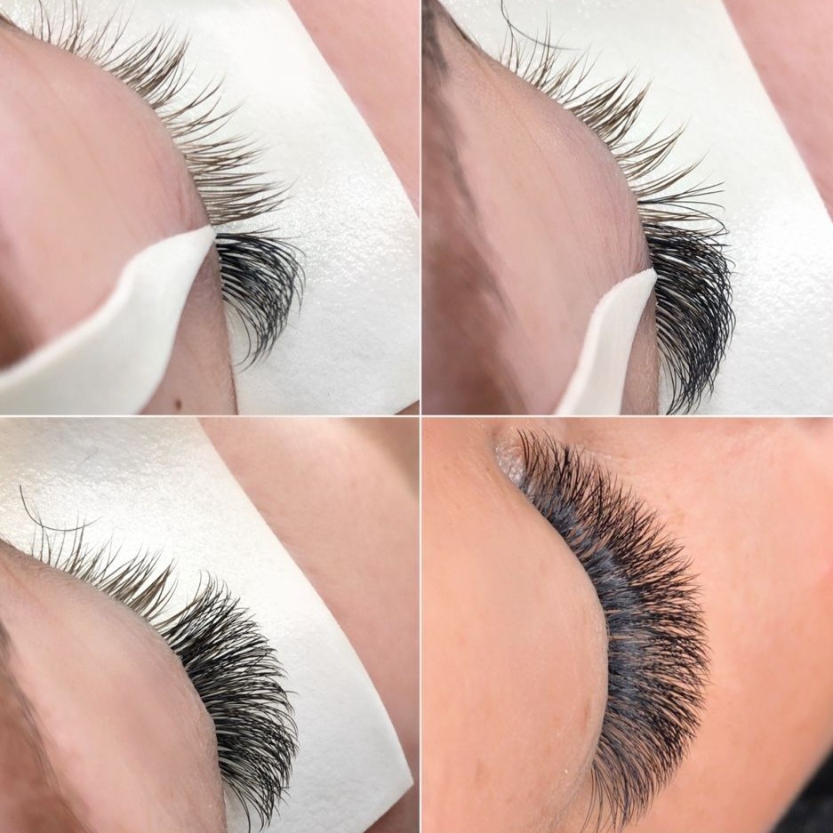 Brow Lifting Ergebnis