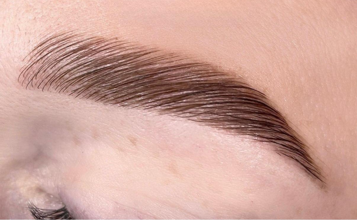 Brow Lifting in Panketal